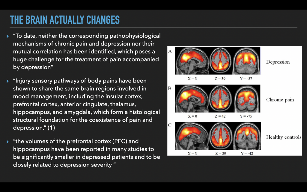 How Depression & Anxiety Are Overlooked in Chronic Low Back Pain